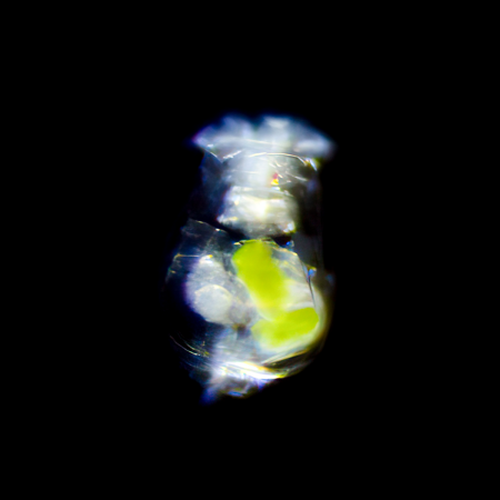 Зоопланктон (Циклоп/коловратка)